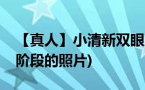 【真人】小清新双眼皮恢复过程(双眼皮恢复阶段的照片)