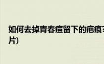 如何去掉青春痘留下的疤痕?(如何去掉青春痘留下的疤痕图片)