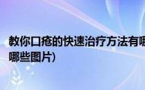 教你口疮的快速治疗方法有哪些(教你口疮的快速治疗方法有哪些图片)