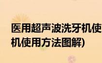 医用超声波洗牙机使用方法(医用超声波洗牙机使用方法图解)