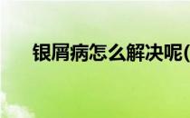 银屑病怎么解决呢(银屑病应该怎么办)