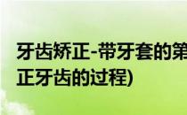 牙齿矫正-带牙套的第一天《感受》(戴牙套矫正牙齿的过程)
