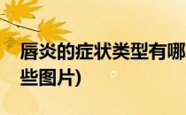 唇炎的症状类型有哪些(唇炎的症状类型有哪些图片)