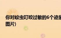 你对蚊虫叮咬过敏的6个迹象(你对蚊虫叮咬过敏的6个迹象图片)