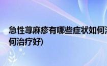 急性荨麻疹有哪些症状如何治疗(急性荨麻疹有哪些症状?如何治疗好)