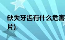 缺失牙齿有什么危害(缺失牙齿有什么危害图片)