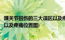 踝关节扭伤的三大误区以及疼痛位置(踝关节扭伤的三大误区以及疼痛位置图)