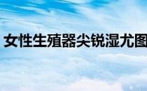 女性生殖器尖锐湿尤图片(女性尖锐湿尤图长)