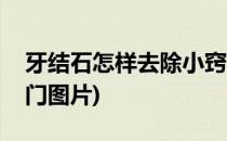 牙结石怎样去除小窍门(牙结石怎样去除小窍门图片)
