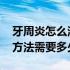 牙周炎怎么治疗大概要多少钱 牙周炎的治疗方法需要多少钱