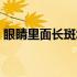 眼睛里面长斑怎么办（眼睛周围长斑怎么办）