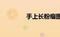 手上长粉瘤图片 粉瘤图片