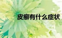 皮癣有什么症状（牛皮癣的症状）
