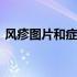 风疹图片和症状图片百度百科 风疹症状图片