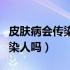 皮肤病会传染吗听听中医怎么说（皮肤病会传染人吗）