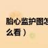 胎心监护图怎么看合格不合格（胎心监护图怎么看）