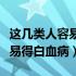 这几类人容易得关节炎赶紧自查（这几类人容易得白血病）