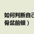 如何判断自己骨盆有没有扩张（如何判断自己骨盆前倾）