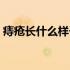 痔疮长什么样子的吃什么药（痔疮长什么样）