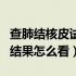 查肺结核皮试结果怎么看（肺结核做皮试正常结果怎么看）