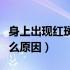 身上出现红斑是什么症状（身上出现红斑是什么原因）