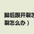 脚后跟开裂怎么办用开塞露可以吗（脚后跟开裂怎么办）
