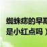 蜘蛛痣的早期症状是起小红点吗（蜘蛛痣早期是小红点吗）