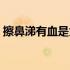 擦鼻涕有血是为什么（擦鼻涕有血什么原因）
