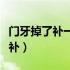 门牙掉了补一颗多少钱（门牙掉了一小块怎么补）