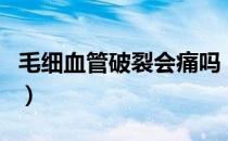 毛细血管破裂会痛吗（毛细血管破裂会自愈吗）