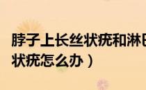 脖子上长丝状疣和淋巴有关系吗（脖子上长丝状疣怎么办）