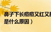 鼻子下长痘痘又红又肿（鼻子长痘痘很痛很红是什么原因）