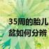 35周的胎儿入盆了吗（怀孕35周胎儿是否入盆如何分辨）