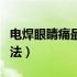电焊眼睛痛最快的方法（电焊眼睛痛最快的方法）