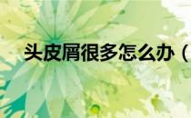 头皮屑很多怎么办（头皮屑很多怎么办）
