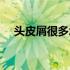 头皮屑很多怎么办（头皮屑很多怎么办）
